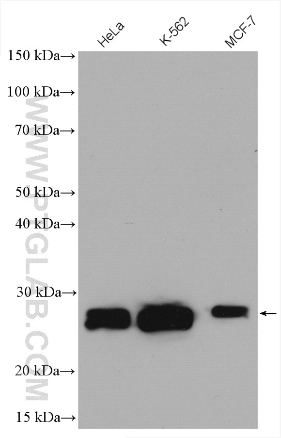 Western Blot (WB) analysis of various lysates using CSNK2B Polyclonal antibody (22418-1-AP)
