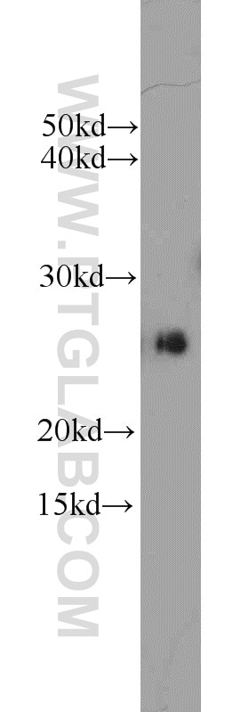 Western Blot (WB) analysis of HepG2 cells using CSNK2B Polyclonal antibody (22418-1-AP)