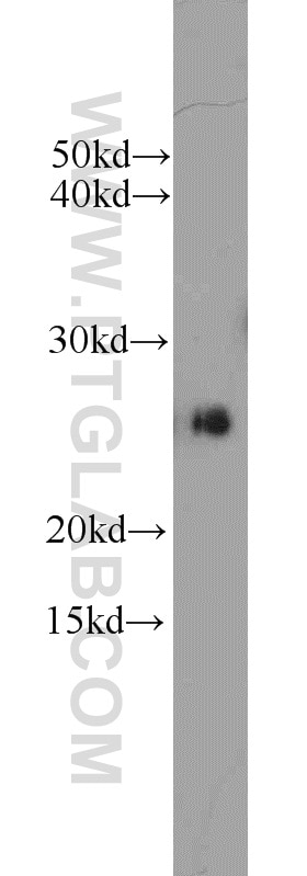 WB analysis of HepG2 using 22418-1-AP