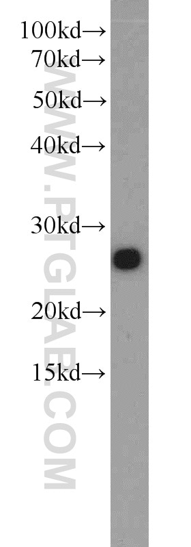 Western Blot (WB) analysis of NIH/3T3 cells using CSNK2B Polyclonal antibody (22418-1-AP)