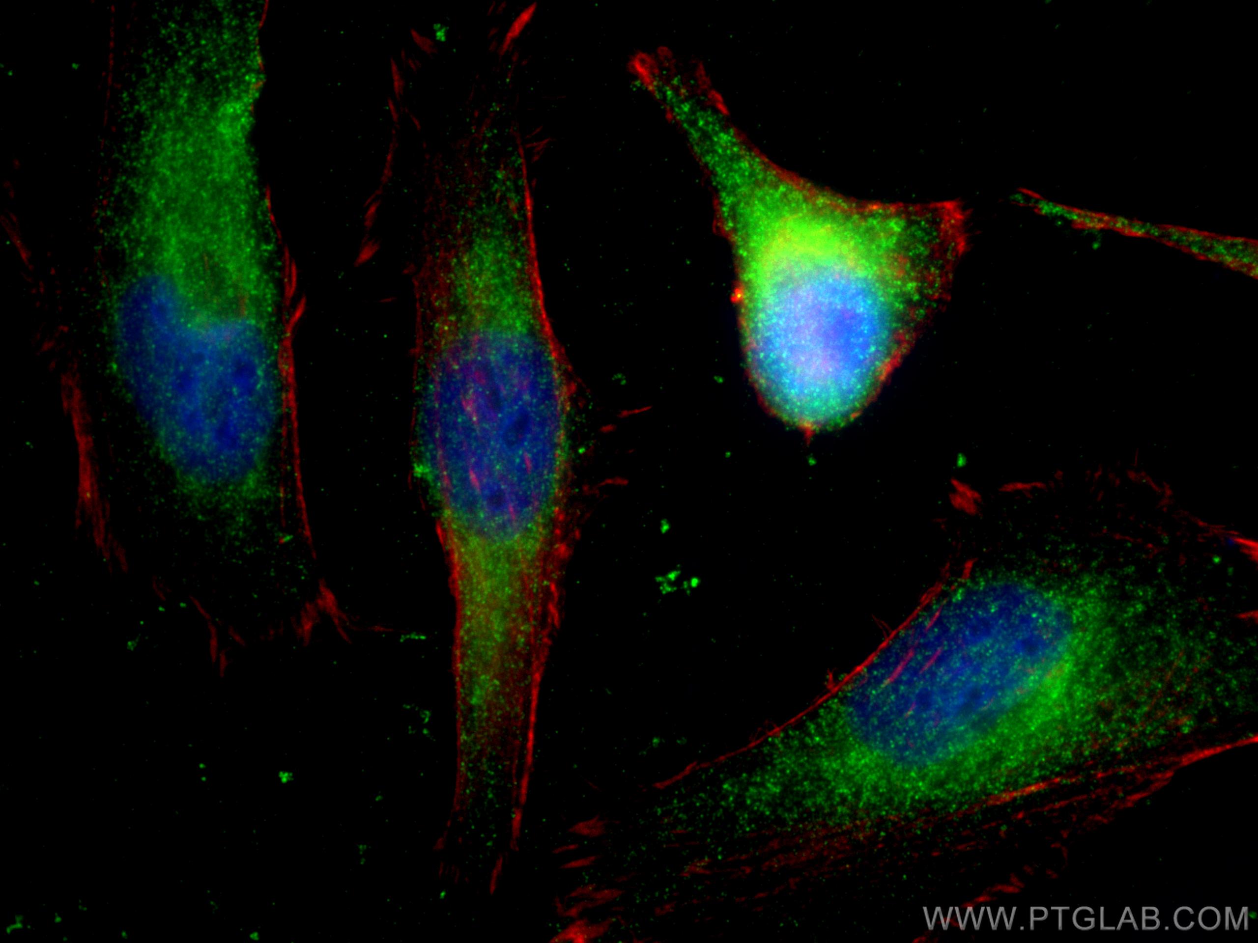 Immunofluorescence (IF) / fluorescent staining of HeLa cells using CSNK2B Monoclonal antibody (67866-1-Ig)