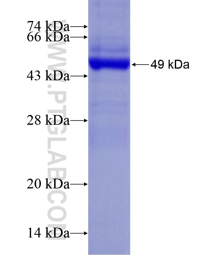 CSNK2B fusion protein Ag18134 SDS-PAGE