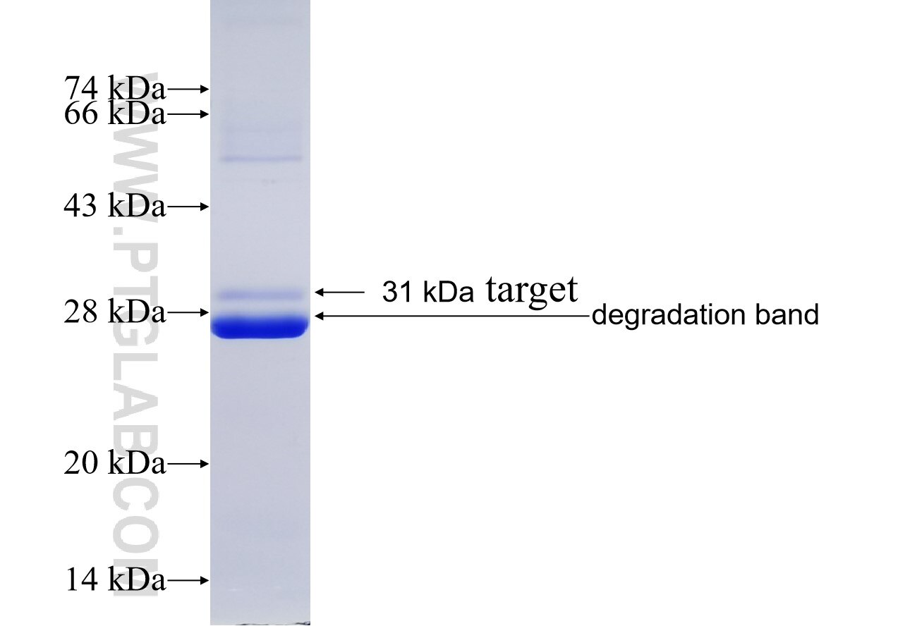 CSNK2B fusion protein Ag19180 SDS-PAGE