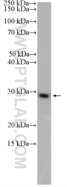 Western Blot (WB) analysis of MCF-7 cells using CSNK2B-specific Polyclonal antibody (20234-1-AP)