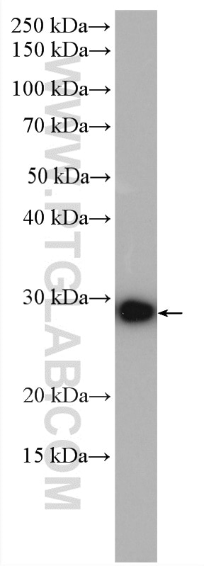 Western Blot (WB) analysis of A431 cells using CSNK2B-specific Polyclonal antibody (20234-1-AP)