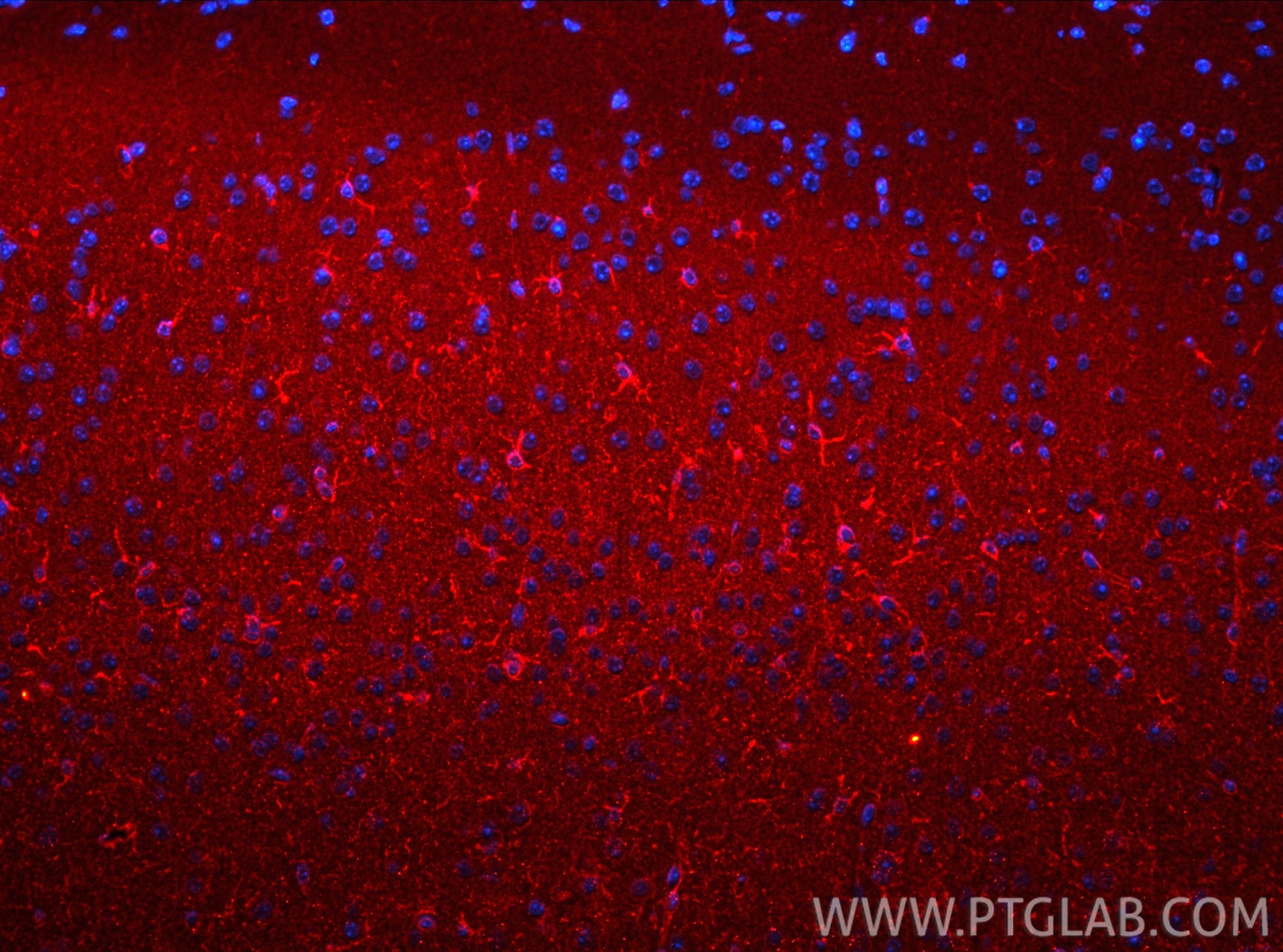 IF Staining of mouse brain using 31623-1-AP Immunofluorescence (IF) / fluorescent staining of mouse brain tissue using CSPG4 Polyclonal antibody (31623-1-AP)