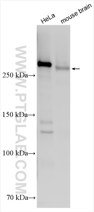 Various lysates were subjected to SDS PAGE followed by western blot with 31623-1-AP (CSPG4 antibody) at dilution of 1:800 incubated at room temperature for 1.5 hours. Western Blot (WB) analysis of various lysates using CSPG4 Polyclonal antibody (31623-1-AP)