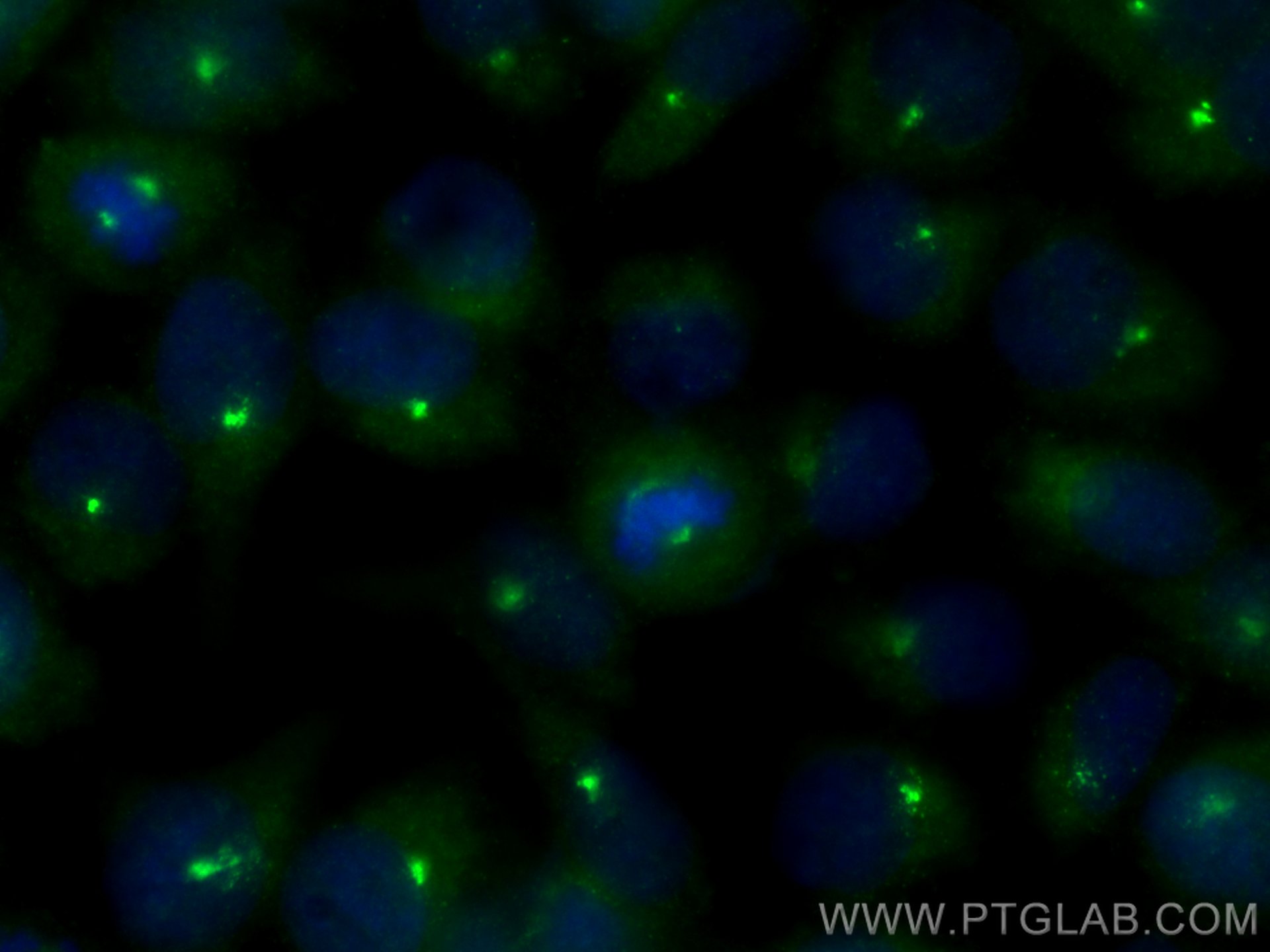 Immunofluorescence (IF) / fluorescent staining of HeLa cells using CSPP1 Polyclonal antibody (11931-1-AP)