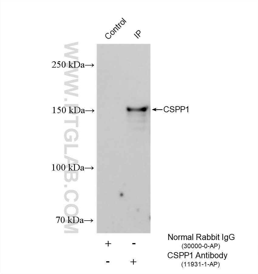 Immunoprecipitation (IP) experiment of Jurkat cells using CSPP1 Polyclonal antibody (11931-1-AP)