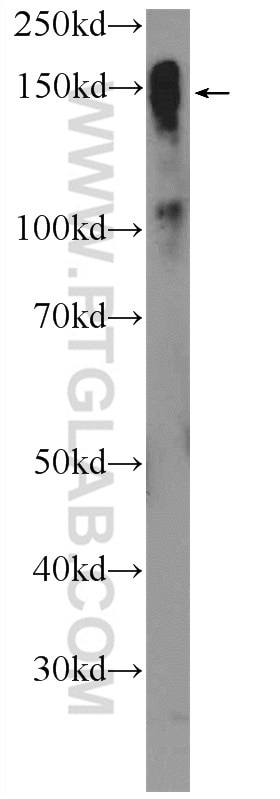 Western Blot (WB) analysis of rat testis tissue using CSPP1 Polyclonal antibody (11931-1-AP)