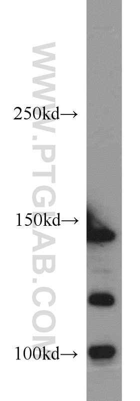 Western Blot (WB) analysis of HeLa cells using CSPP1 Polyclonal antibody (11931-1-AP)