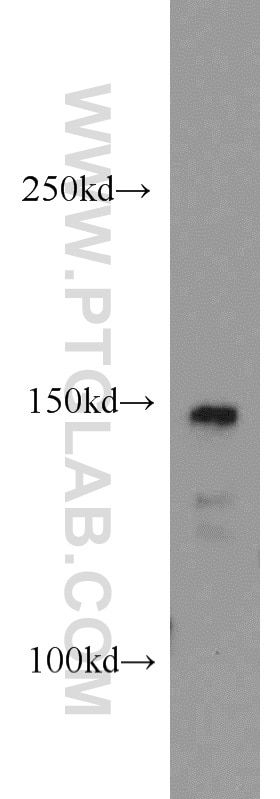Western Blot (WB) analysis of Jurkat cells using CSPP1 Polyclonal antibody (11931-1-AP)
