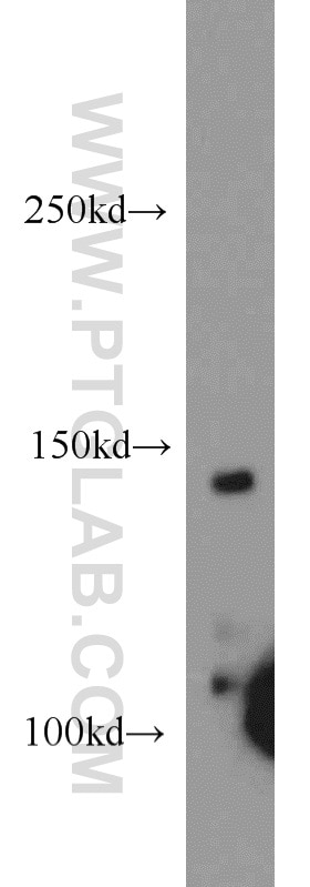 Western Blot (WB) analysis of mouse testis tissue using CSPP1 Polyclonal antibody (11931-1-AP)