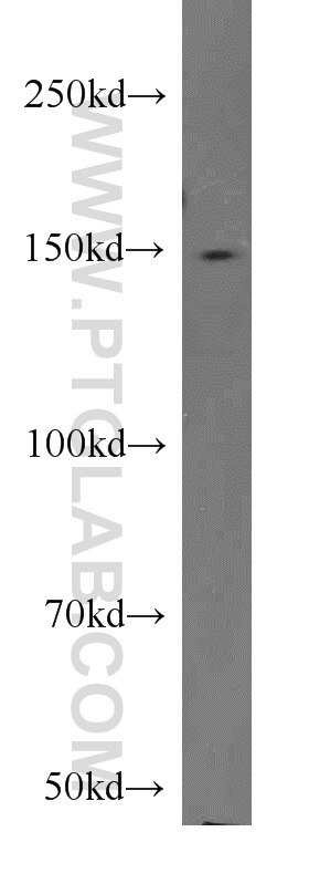 Western Blot (WB) analysis of HEK-293 cells using CSPP1 Polyclonal antibody (11931-1-AP)