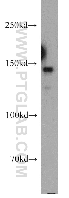 Western Blot (WB) analysis of Jurkat cells using CSPP1 Polyclonal antibody (11931-1-AP)