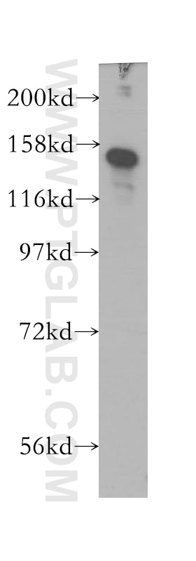Western Blot (WB) analysis of HEK-293 cells using CSPP1 Polyclonal antibody (11931-1-AP)