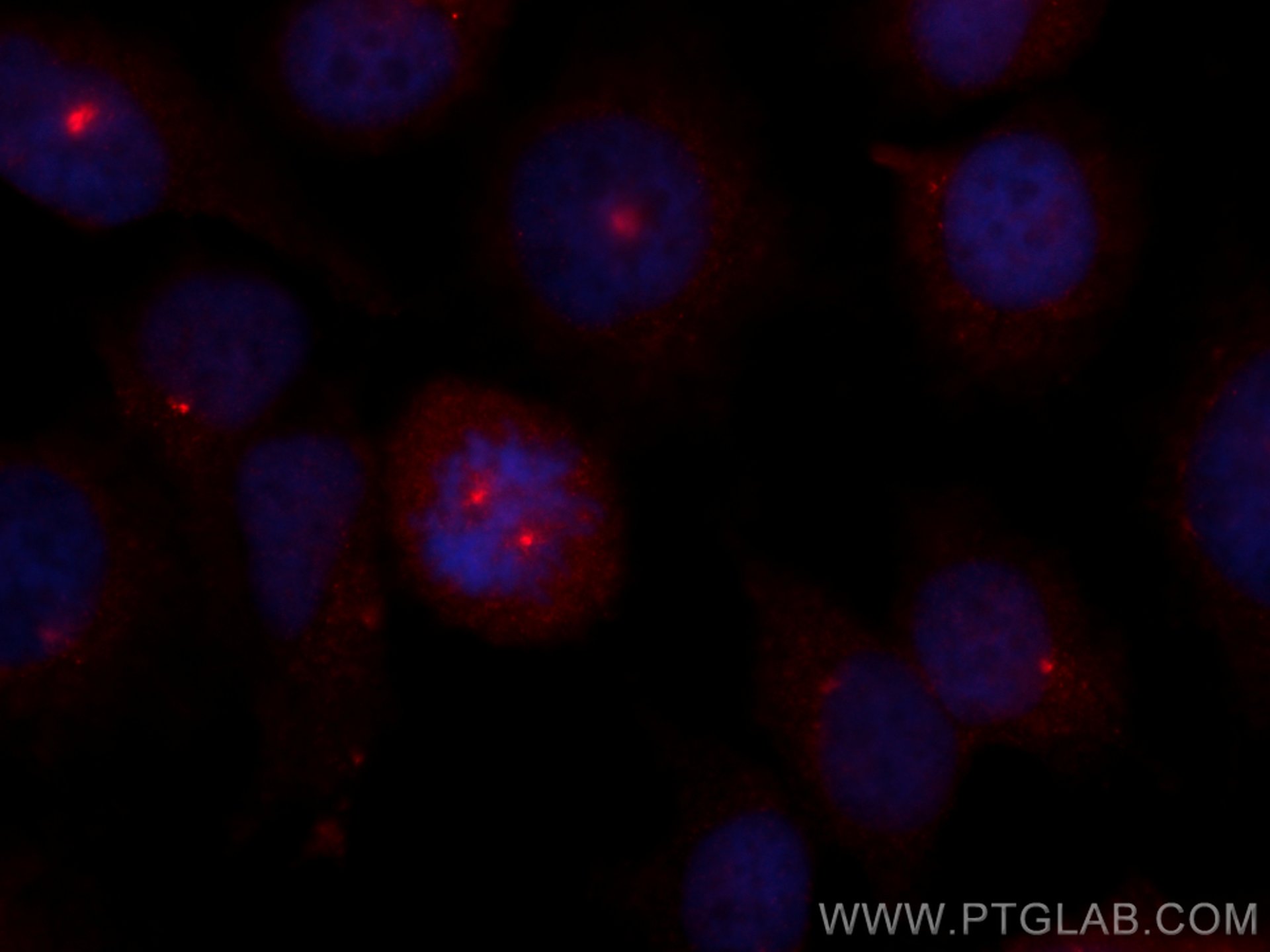 Immunofluorescence (IF) / fluorescent staining of HeLa cells using CoraLite®594-conjugated CSPP1 Polyclonal antibody (CL594-11931)