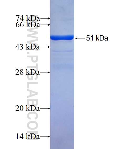 CSPP1 fusion protein Ag2521 SDS-PAGE