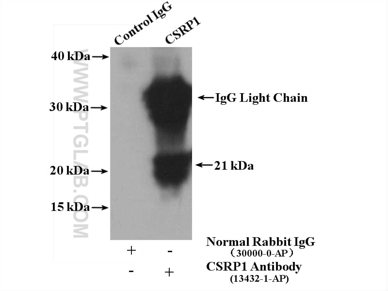 Immunoprecipitation (IP) experiment of mouse stomach tissue using CSRP1 Polyclonal antibody (13432-1-AP)