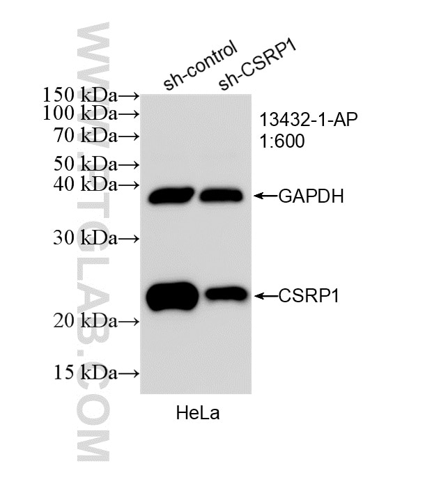Western Blot (WB) analysis of HeLa cells using CSRP1 Polyclonal antibody (13432-1-AP)