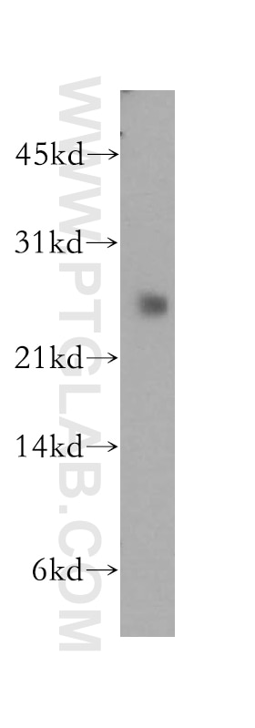 Western Blot (WB) analysis of human stomach tissue using CSRP1 Polyclonal antibody (13432-1-AP)