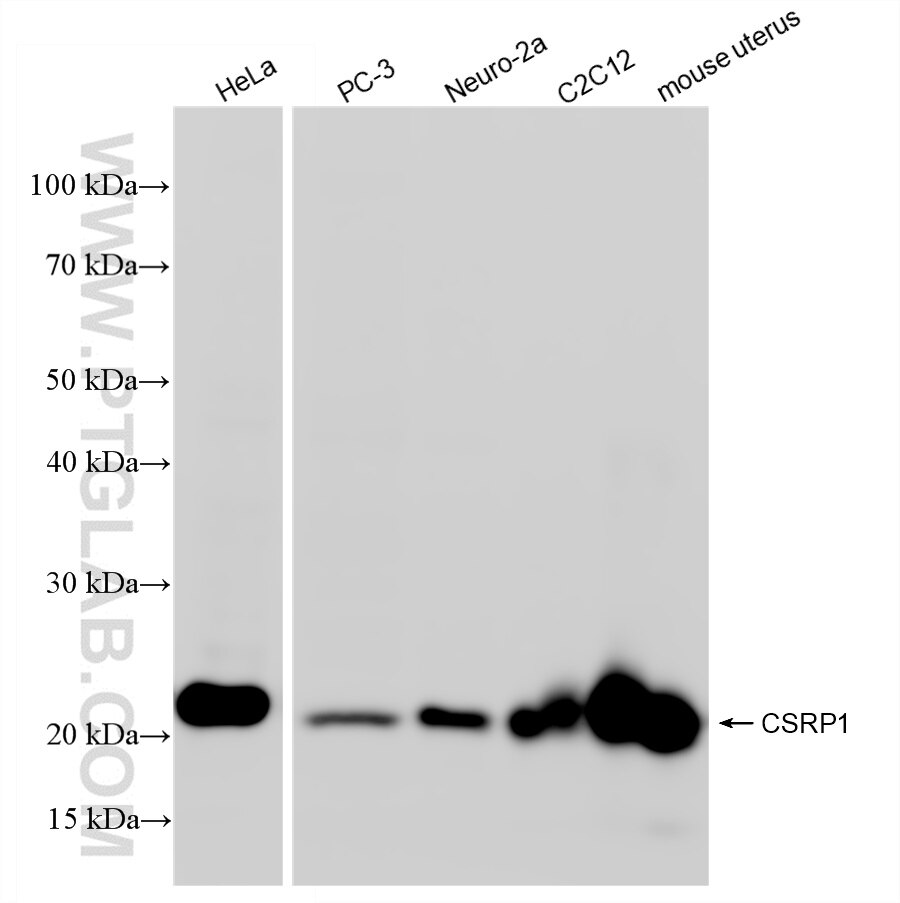 Western Blot (WB) analysis of various lysates using CSRP1 Recombinant antibody (86265-3-RR)