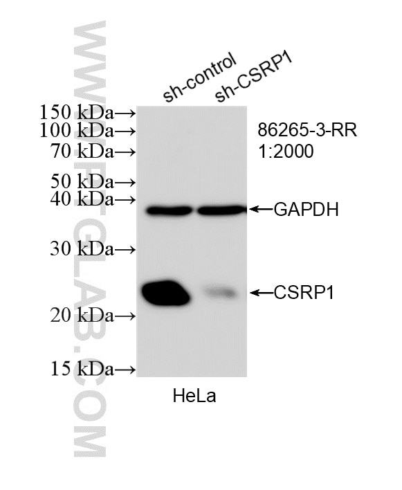 WB analysis of HeLa using 86265-3-RR Western Blot (WB) analysis of HeLa cells using CSRP1 Recombinant monoclonal antibody (86265-3-RR)