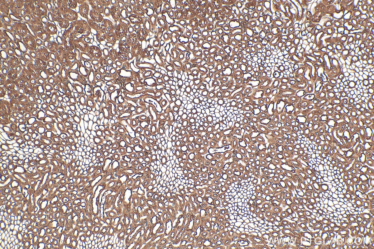 Immunohistochemistry (IHC) staining of mouse kidney tissue using CSRP2 Polyclonal antibody (10892-2-AP)