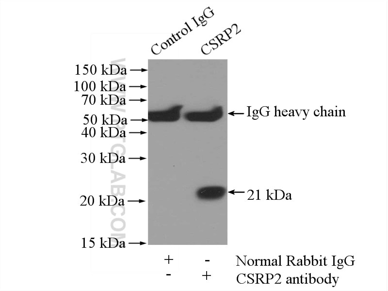 Immunoprecipitation (IP) experiment of mouse liver tissue using CSRP2 Polyclonal antibody (10892-2-AP)