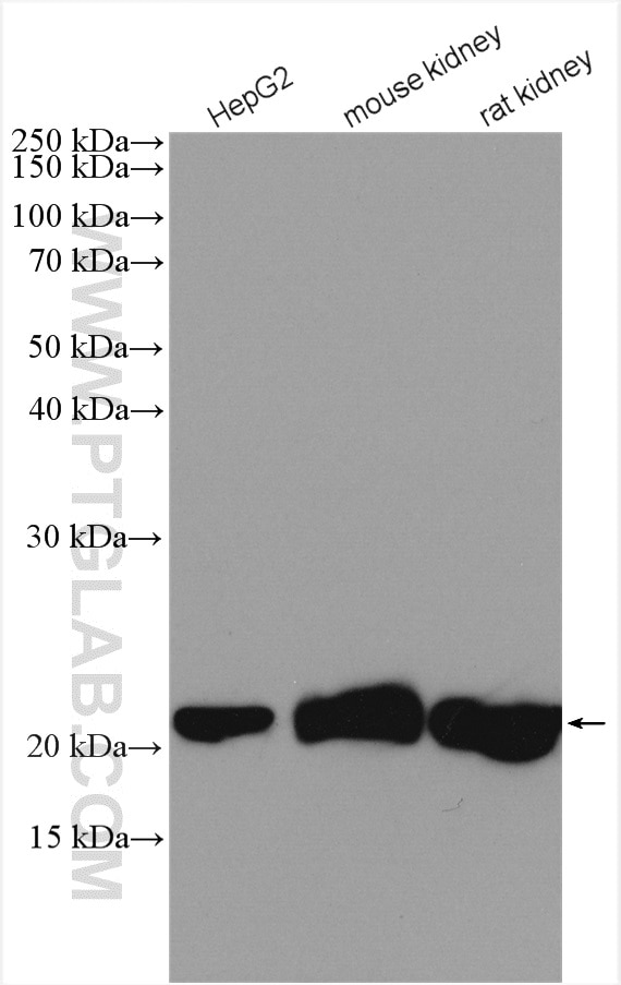 Western Blot (WB) analysis of various lysates using CSRP2 Polyclonal antibody (10892-2-AP)