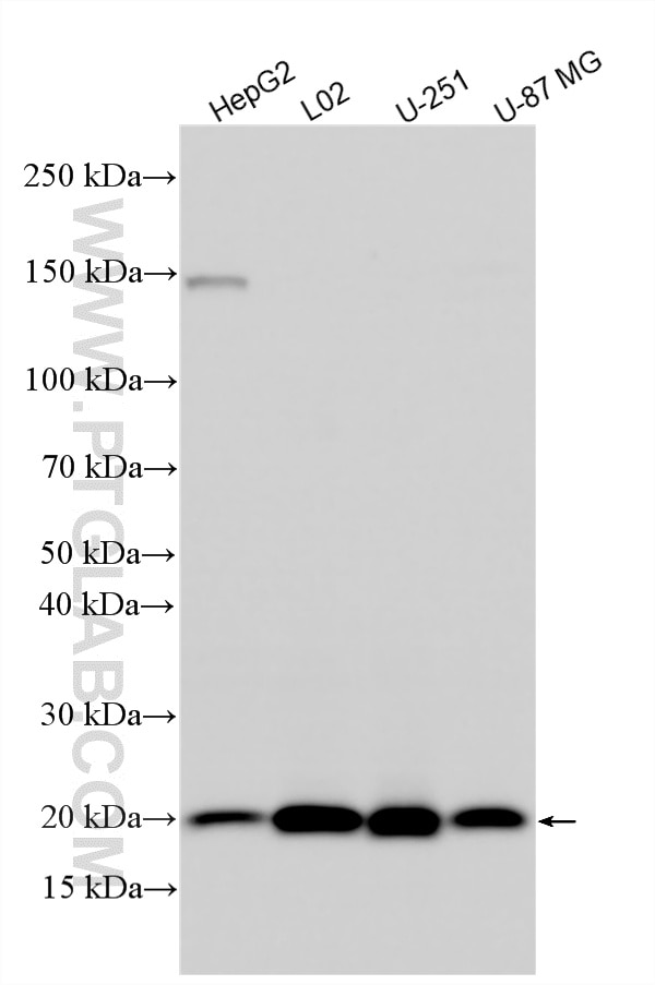 Western Blot (WB) analysis of various lysates using CSRP2 Polyclonal antibody (10892-2-AP)