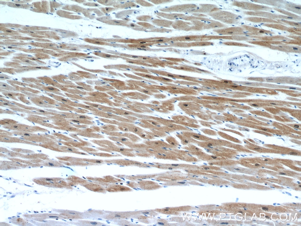 IHC staining of human heart using 10721-1-AP