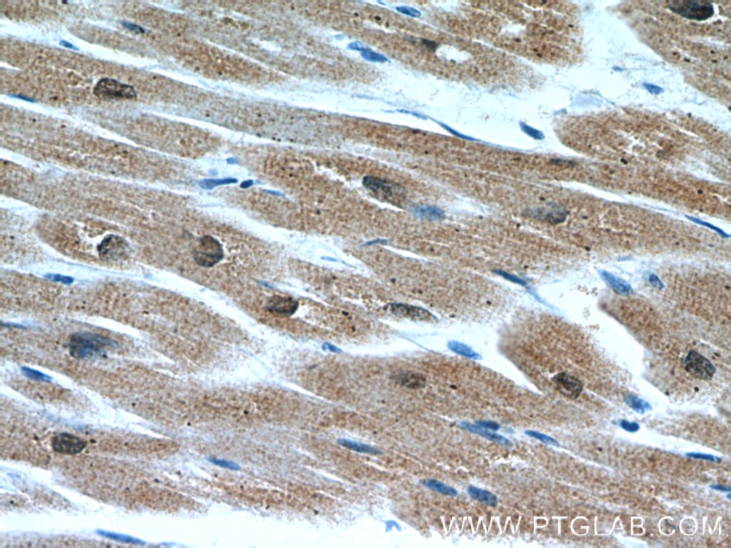 Immunohistochemistry (IHC) staining of human heart tissue using CSRP3 Polyclonal antibody (10721-1-AP)