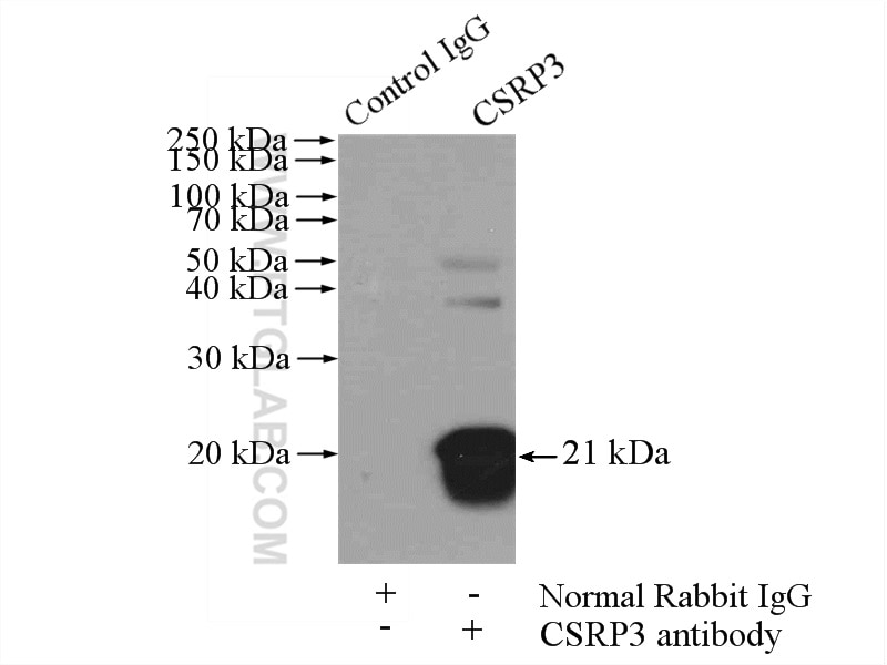 Immunoprecipitation (IP) experiment of mouse heart tissue using CSRP3 Polyclonal antibody (10721-1-AP)