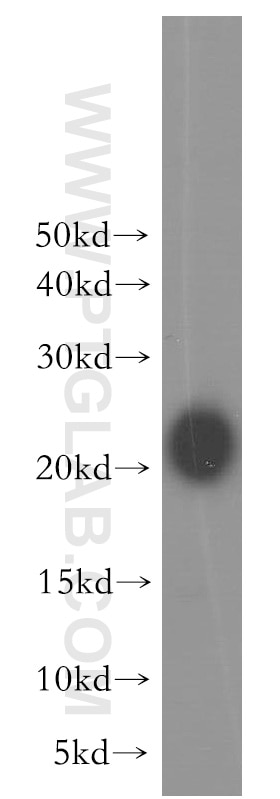 Western Blot (WB) analysis of human heart tissue using CSRP3 Polyclonal antibody (10721-1-AP)