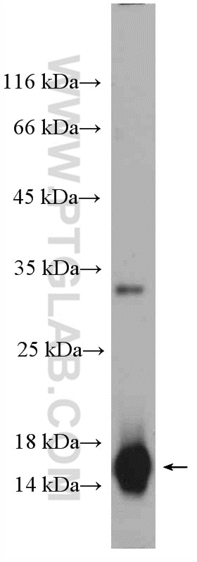 Western Blot (WB) analysis of human saliva using Cystatin SN/CST1 Polyclonal antibody (16025-1-AP)