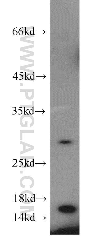 Western Blot (WB) analysis of COLO 320 cells using CST1 Polyclonal antibody (16025-1-AP)