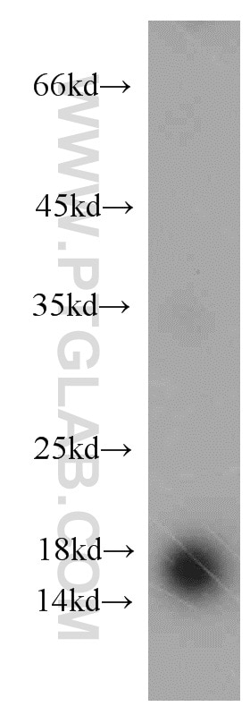 Western Blot (WB) analysis of human adrenal gland tissue using CST1 Polyclonal antibody (16025-1-AP)