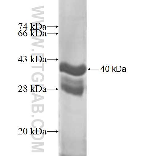 CST1 fusion protein Ag8862 SDS-PAGE