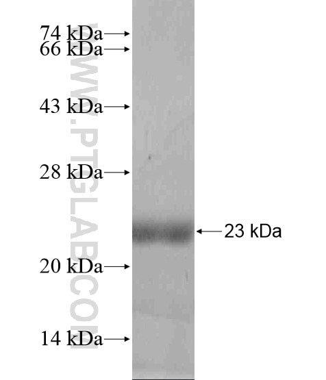 CST11 fusion protein Ag18638 SDS-PAGE