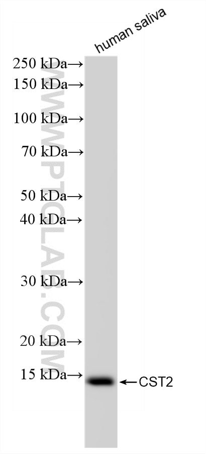 Western Blot (WB) analysis of human saliva using CST2 Recombinant monoclonal antibody (86701-1-RR)