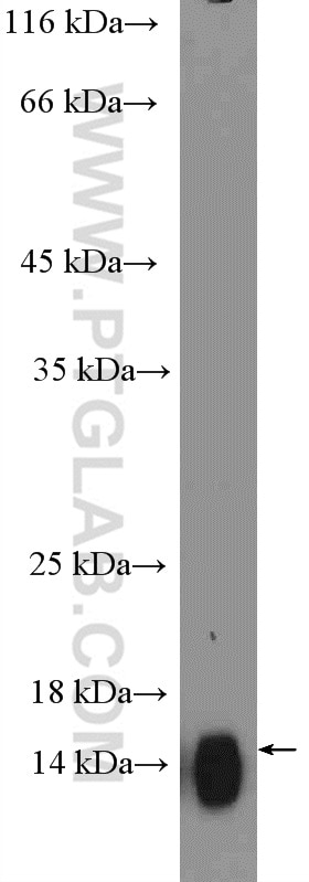 Western Blot (WB) analysis of human saliva using CST2-Specific Polyclonal antibody (19935-1-AP)