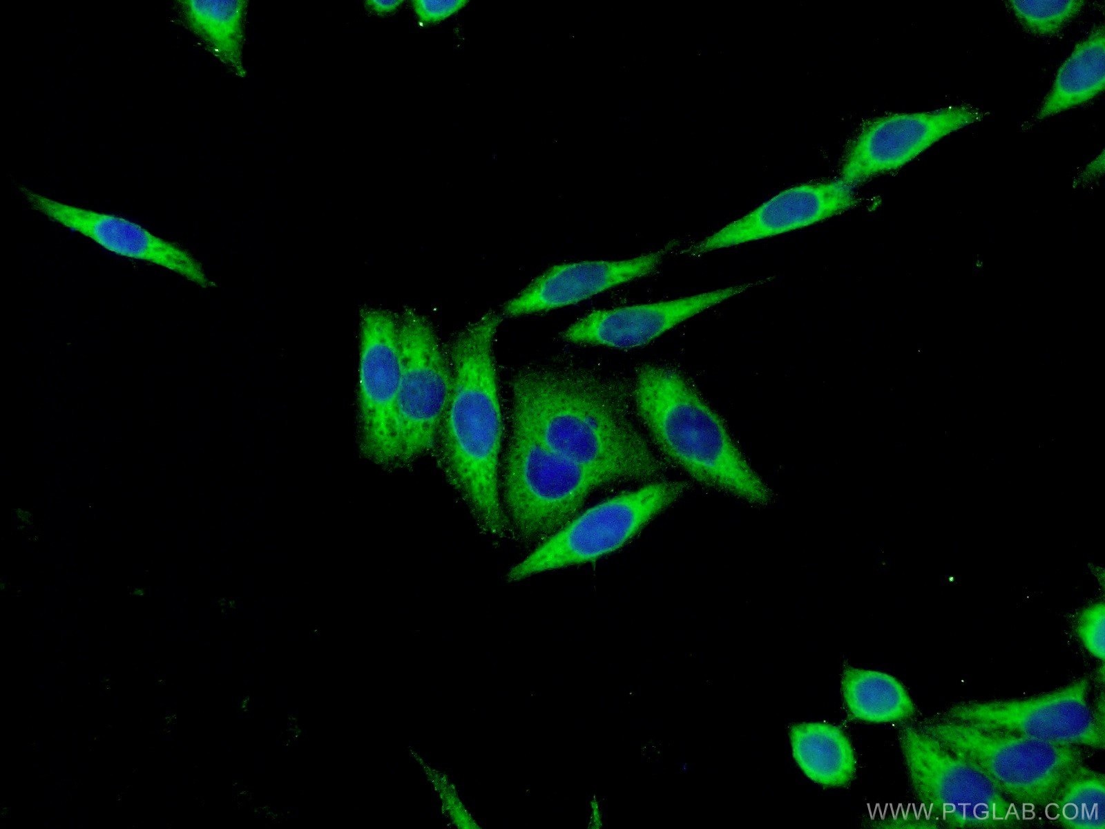 Immunofluorescence (IF) / fluorescent staining of HeLa cells using Cystatin C Polyclonal antibody (12245-1-AP)