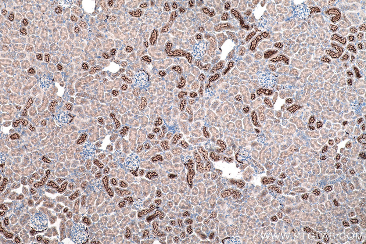 Immunohistochemistry (IHC) staining of mouse kidney tissue using Cystatin C Polyclonal antibody (12245-1-AP)