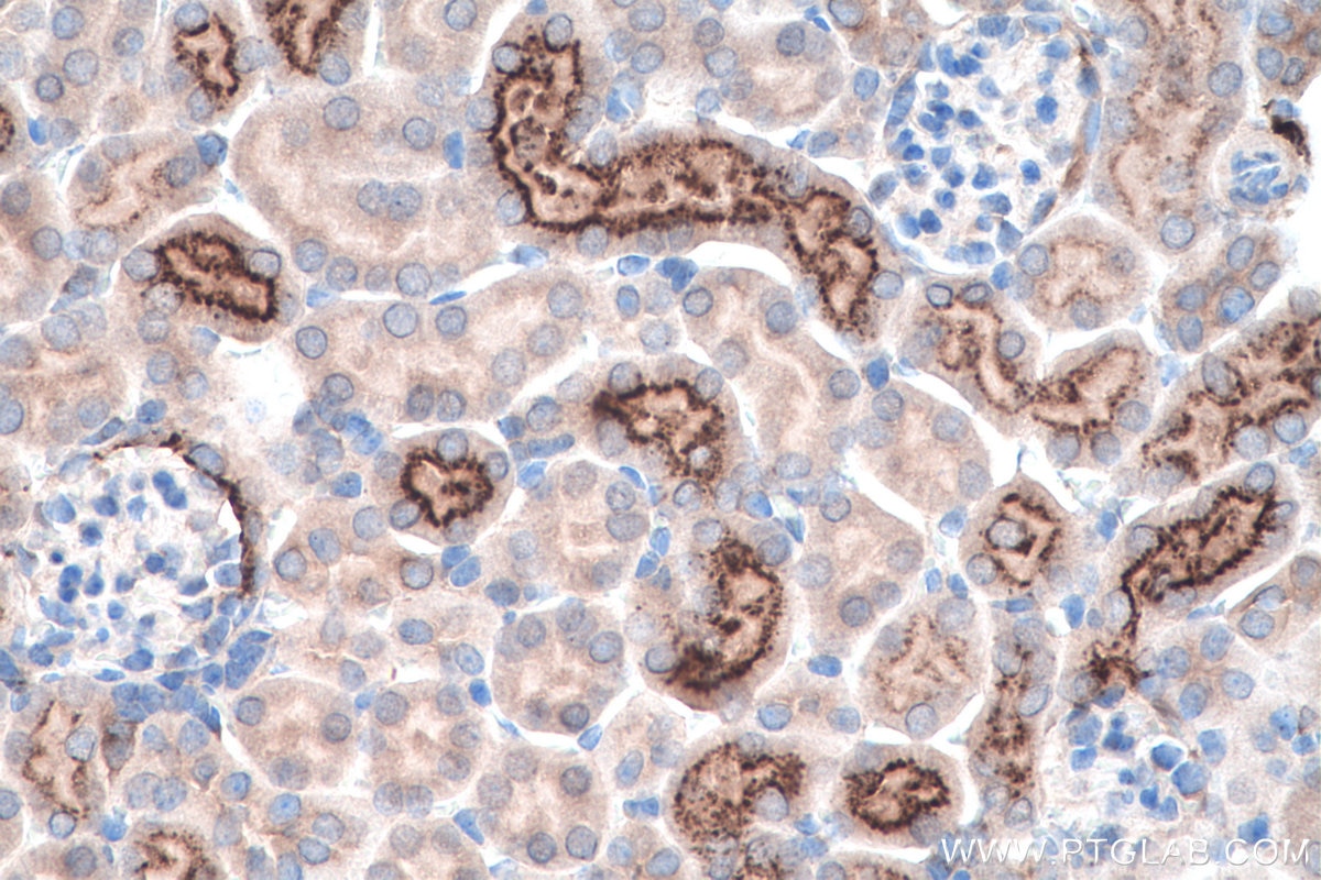 Immunohistochemistry (IHC) staining of mouse kidney tissue using Cystatin C Polyclonal antibody (12245-1-AP)