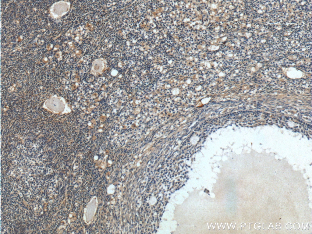 Immunohistochemistry (IHC) staining of human ovary tissue using Cystatin C Polyclonal antibody (12245-1-AP)