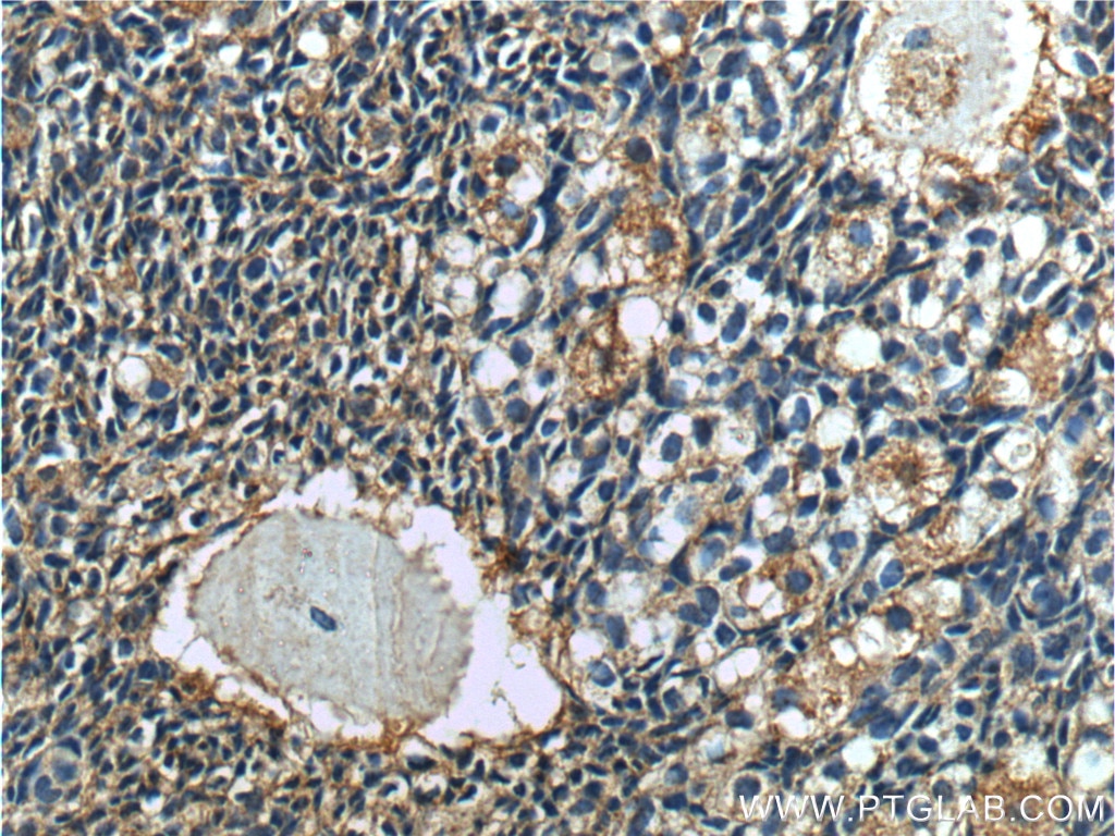 Immunohistochemistry (IHC) staining of human ovary tissue using Cystatin C Polyclonal antibody (12245-1-AP)