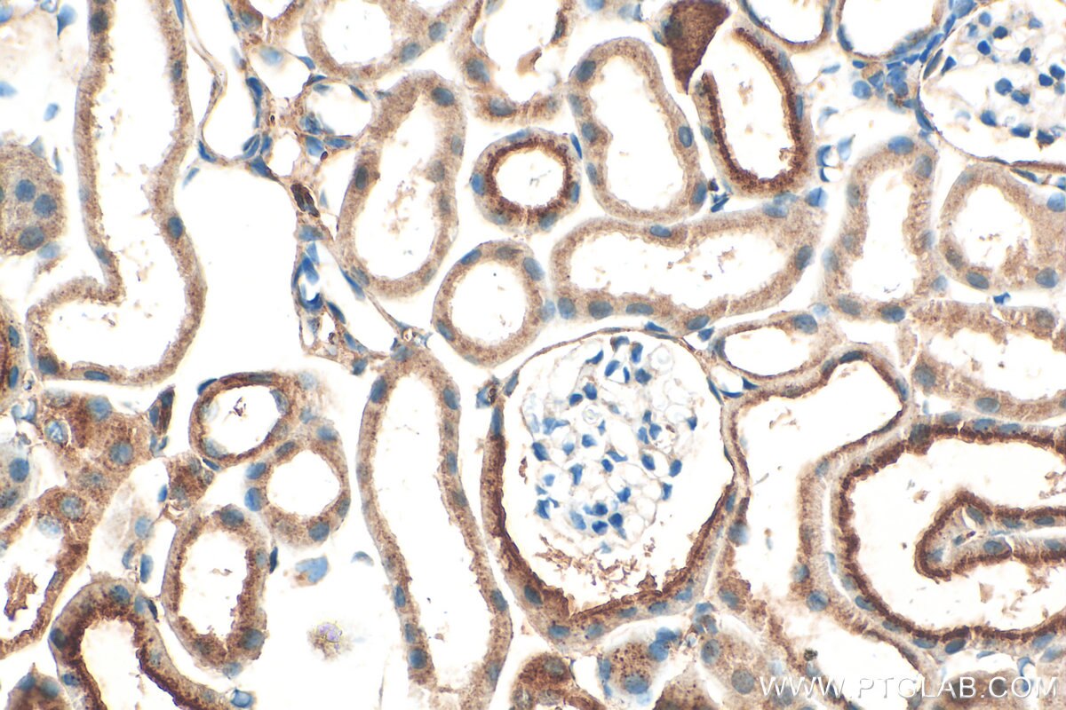 Immunohistochemistry (IHC) staining of mouse kidney tissue using Cystatin C Polyclonal antibody (12245-1-AP)