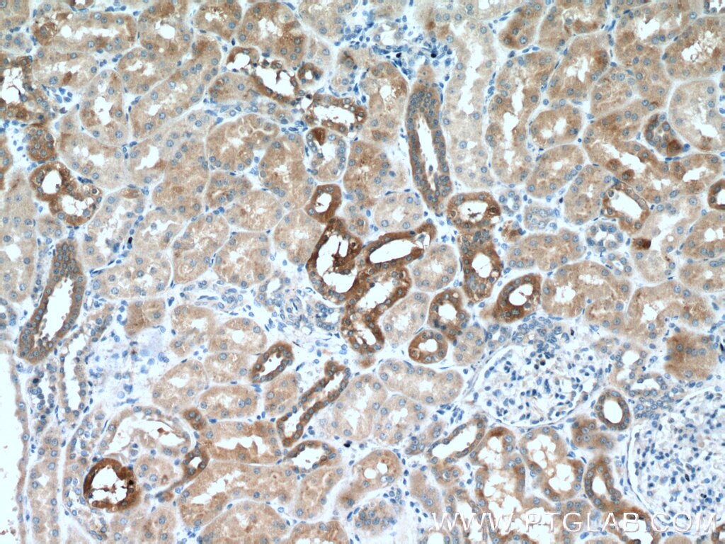 Immunohistochemistry (IHC) staining of human kidney tissue using Cystatin C Polyclonal antibody (12245-1-AP)