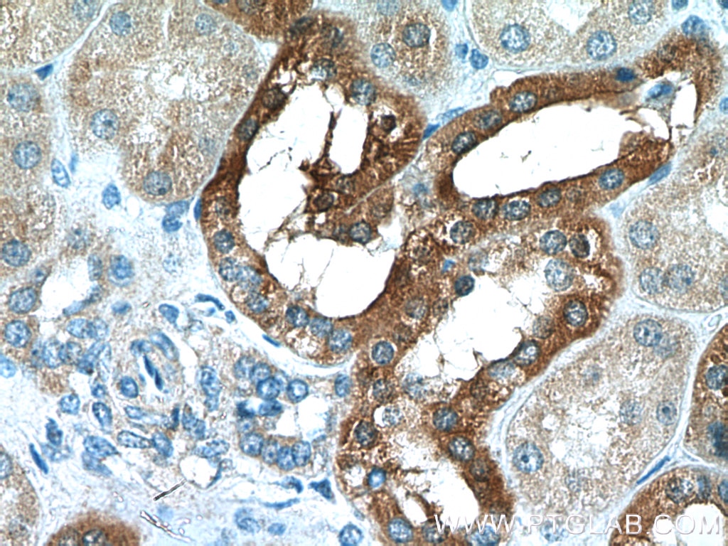 Immunohistochemistry (IHC) staining of human kidney tissue using Cystatin C Polyclonal antibody (12245-1-AP)